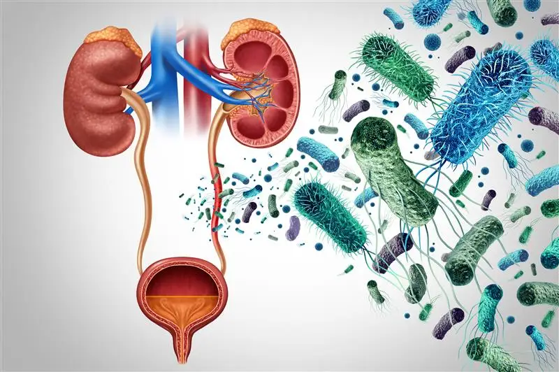 Несеп шығару жүйесі 3