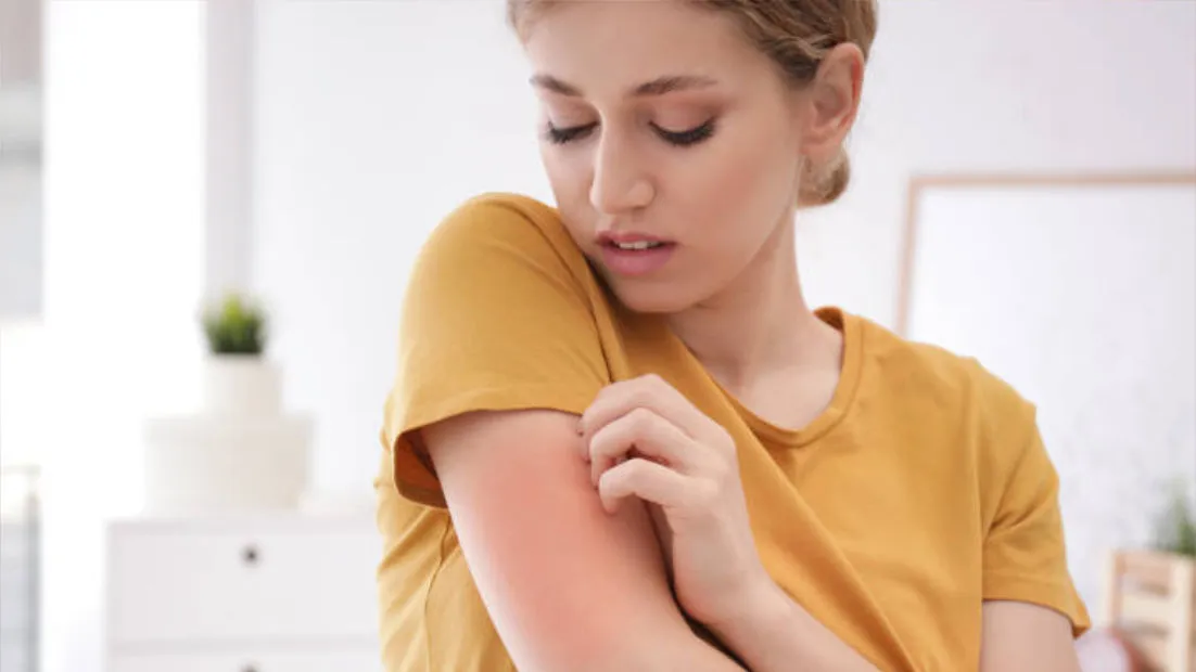 Lokalisation-Neurodermitis