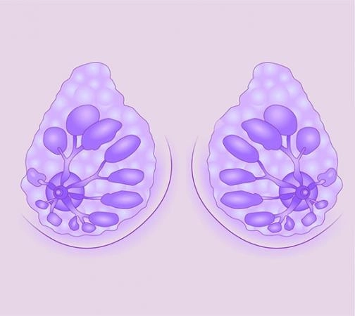 мастопатия