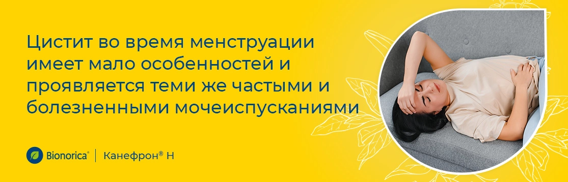 Как проявляется цистит при менструации?