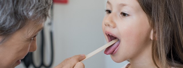 Streptokokken führen häufig zu Halsentzündungen