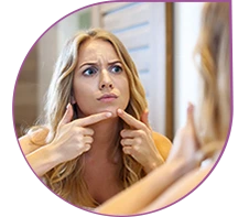 Угревая сыпь 