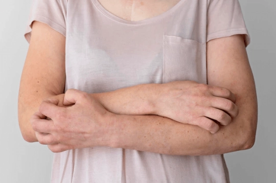 Климакс кезіндегі қышыну 2