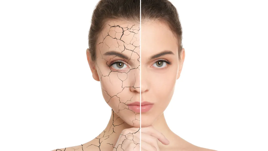Ursachen-trockener-Haut