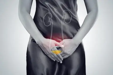 Циститтің белгілері