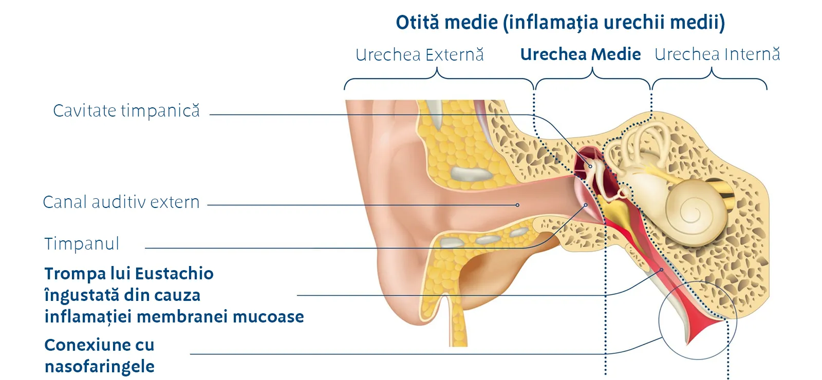 infectie ureche