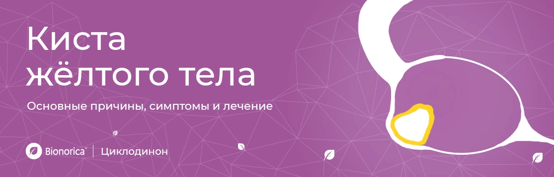 Киста жёлтого тела: основные причины, симптомы и лечение