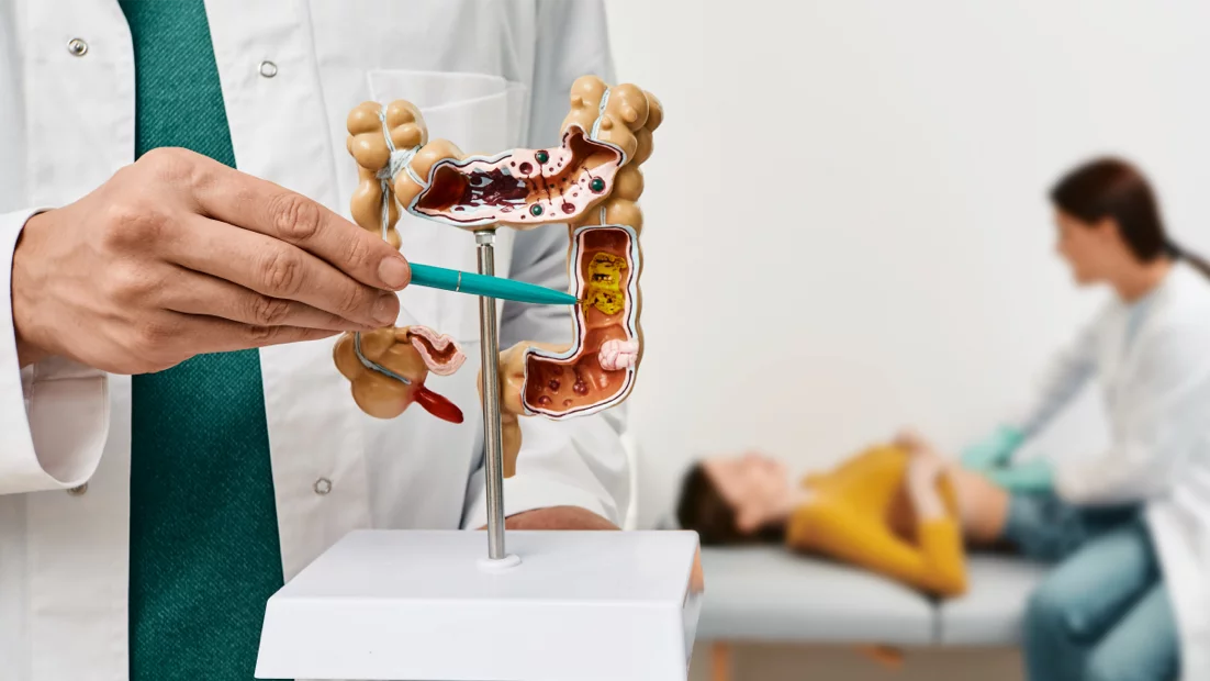 Darmprobleme: Reizdarm oder chronisch-entzündliche Darmerkrankung